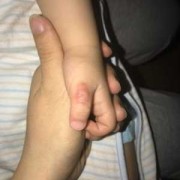 宝宝总吸吮手指是什么情况？宝宝快三个月了，发育不好吗,胎儿在肚子里吃手指会影响面容发育吗