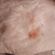 孕期白带白色（怀孕有淡粉色白带怎么回事）