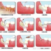 孕期可以拔智齿吗（孕期可以拔智齿吗?）