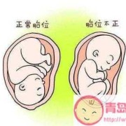 胎儿屁股朝下（胎儿屁股朝下有什么说法）
