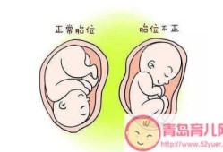 胎儿屁股朝下（胎儿屁股朝下有什么说法）