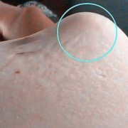胎儿踢肚子（胎儿踢肚子是什么感觉）