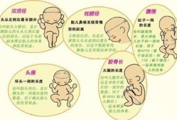 IT是胎儿的什么（IT是胎儿的什么意思）