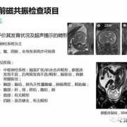 核磁共振对胎儿有影响吗（胎儿做核磁共振对胎儿有影响吗）