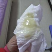 怀孕了还会有白带吗,
