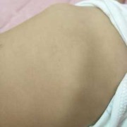 胎儿肋骨图（胎儿肋骨图片）