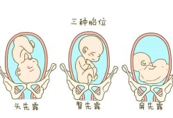 30周胎儿在母体的姿势（30周胎儿在母体的姿势是横位）