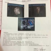 13岁女孩143厘米还可以长多高,胎儿心率143是男孩儿是女孩儿