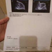 孕期6周（怀孕十三周加六是多少天了）