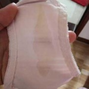 孕期水样白带是怎么回事（为什么白带像水一样流着的呢，孕妇这样的症状是羊水破了吗，怎么办啊）