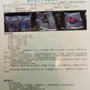 胎儿心脏超声（胎儿心脏超声多少周做合适）