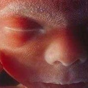 28周胎儿有多大,孕28周胎儿2斤正常吗为什么