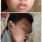 胎儿张嘴什么原因（婴儿张嘴睡觉正常吗）