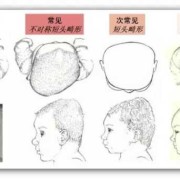 胎儿头太大怎么办（胎儿头偏大多少是畸形）