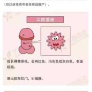 孕妇得了尖锐湿疣如何治疗,孕期得了尖疣有没有影响