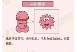 孕妇得了尖锐湿疣如何治疗,孕期得了尖疣有没有影响