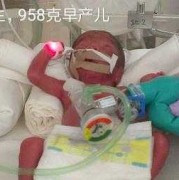 29周胎儿视频（怀孕29周出生胎儿能活吗）