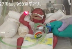 29周胎儿视频（怀孕29周出生胎儿能活吗）