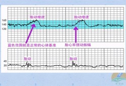 胎心是不是胎儿的心脏（胎心是不是胎儿的心脏跳动）