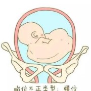 胎儿前肩（胎儿前肩是哪个部位）