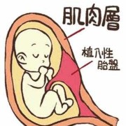 胎盘植入对胎儿的影响（胎盘植入对胎儿的影响有哪些）