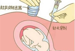 羊穿对胎儿有影响吗（羊穿对胎儿有影响吗?）