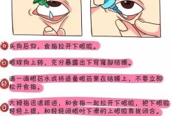孕妇能滴眼药水吗,怀孕滴眼药水对胎儿有影响吗
