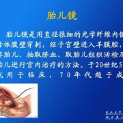 胎镜是什么,胎儿镜的费用多少钱
