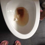 怀孕后发现每次尿尿，气味特别大，什么原因,孕期尿多生女儿吗