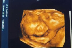 四维宣布宝宝的到来文案,23周四维图片胎儿全图