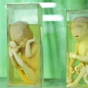 胎儿标本（dna标本保存怎么收费）