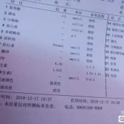 体检单上怎么分男女,尿液酸碱度看胎儿性别准吗