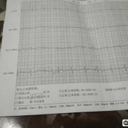 22周胎儿图片（孕22周胎儿心率163-146，很不好吗）