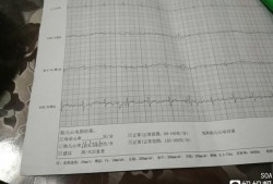 22周胎儿图片（孕22周胎儿心率163-146，很不好吗）