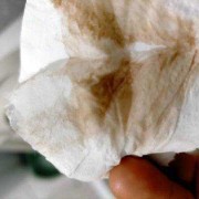 孕期第八周（孕期第八周有一点出血）