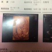五个月宝宝最大可以听多大声,胎儿能听见多大的声音