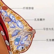 乳腺增生是怎么得的,孕期会乳腺增生吗?