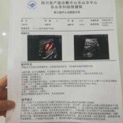 胎儿心脏间隙（胎儿心脏间隙大是什么原因）