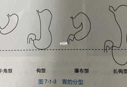 胎儿胃泡大孩子能要吗（1.孕32周，胎方位臀部，胃泡位于左侧）