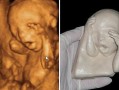 怀孕21周胎儿图（二十周胎儿有多大）