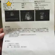 一位孕妈的孕期日记（一位孕妈的孕期日记怎么写）