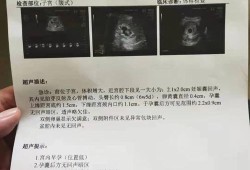 一位孕妈的孕期日记（一位孕妈的孕期日记怎么写）