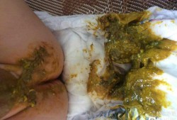 胎儿拉屎吗（胎儿拉屎吗?怎么排便）