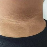 孕期脖子变黑是男孩吗（孕期脖子变黑是男孩吗）