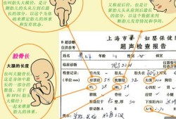 怎么看胎儿b超图（怎么看胎儿b超图像）