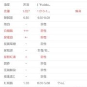孕期尿检细菌值偏高（孕期尿检细菌值偏高怎么回事）