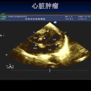 如何促进胎儿心脏发育（孕检心脏彩超能查出什么）