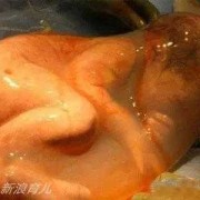 蜷着的胎儿是男孩女孩（蜷着的胎儿是男孩女孩）