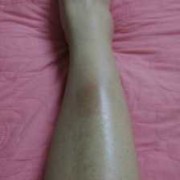 孕期小腿硬（孕期小腿硬邦邦是怎么回事）