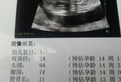 孕期nt几周做最好（孕期nt几周做最好,要空腹吗）